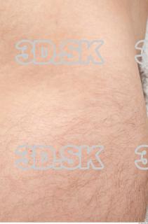 Skin texture of Emilio 0002